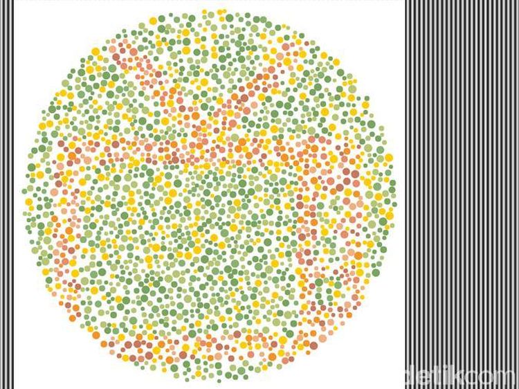 Tes Buta Warna! Gagal Temukan Gambar TV, Tandanya Harus Periksa