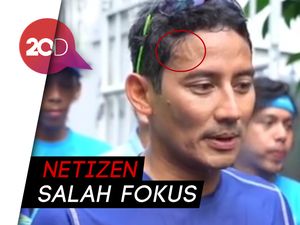 Kenapa Saat Olahraga Muncul Urat Seperti di Dahi Sandiaga Uno?
