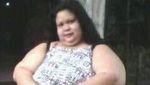 Potret Perjalanan Bobot Wanita Kalteng hingga Seberat 350 Kg
