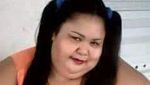 Potret Perjalanan Bobot Wanita Kalteng hingga Seberat 350 Kg