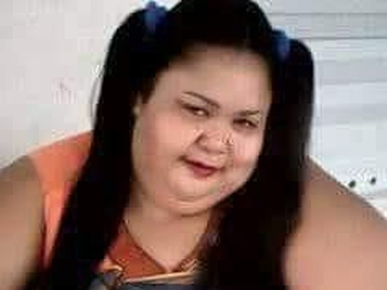 Syukurlah, Titi Wati 220 Kg Sudah Bisa Duduk Syukurlah, Titi Wati 220 Kg Sudah Bisa Duduk