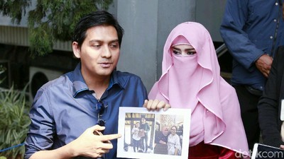 Lucky Hakim dan Mantan Istri Buat Sayembara Rp 50 Juta
