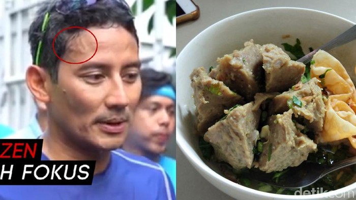 Ada Di Bakso Dan Pelipis Sandiaga Sebenarnya Urat Itu Apa Sih