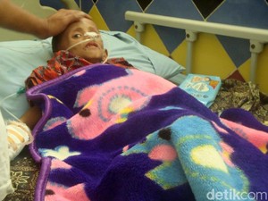 Alami Gangguan Pencernaan, Balita di Purbalingga Berbobot 10 Kg