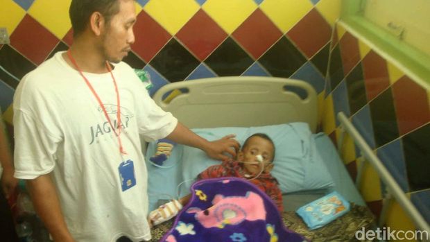 Alami Gangguan Pencernaan, Balita di Purbalingga Berbobot 10 Kg