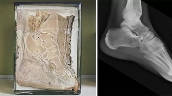 Perbandingan bagian dalam kaki gajah dan manusia. (Foto: Boredpanda)