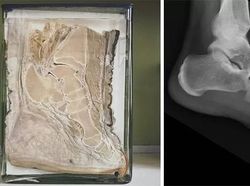 Kumpulan Foto Perbandingan yang Membuka Pikiran