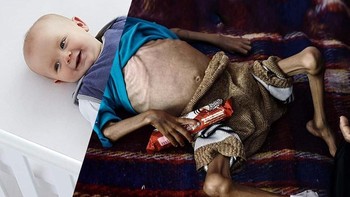 Diharapkan semua itu dapat membuka mata semua orang. Foto: Uğur Gallenkuş