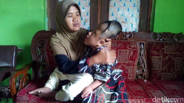 Zaki dan Ulil, Bocah Satu Desa di Kudus Derita Hidrosefalus