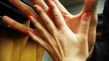 Tangan wanita ini terlihat sangat kecil ketika disatukan dengan tangan pemain bola basket. (Foto: boredpanda)