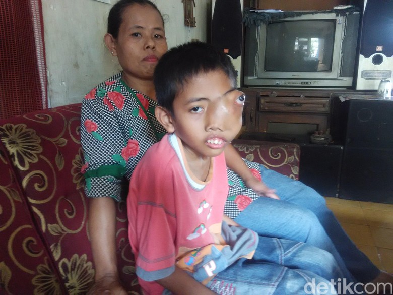 Semangat Bocah Padalarang Melawan Tumor Sinonasal Semangat Bocah Padalarang Melawan Tumor Sinonasal