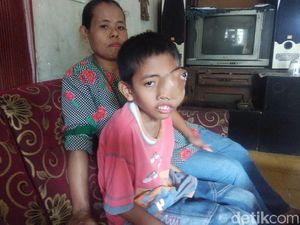 Semangat Bocah Padalarang Melawan Tumor Sinonasal