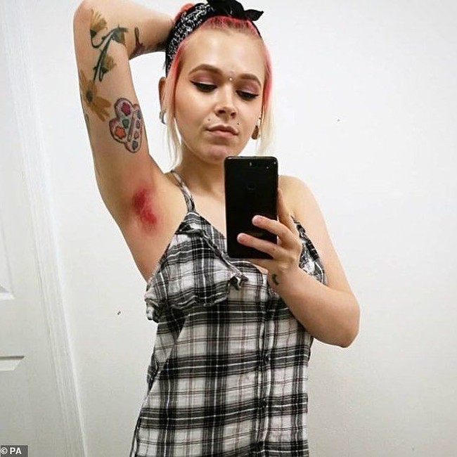 Sejumlah perempuan mengunggah foto pamer ketiak dengan bulu warna-warni. Warnanya yang dipakai bertabrakan seperti warna unicorn. Namun, ada pula yang memakai warna pelangi. Foto: Istimewa