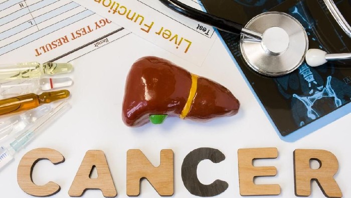 Liver cancer concept photo. Anatomical shape of liver lies near letters composing word cancer surrounded by set of tests, analysis, drugs, MRI and stethoscope. Diagnosis treatment of cancerous liver