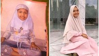 Sepuluh tahun yang lalu, Zahra (20) masih begitu polos untuk memahami kanker ovarium yang ia alami. Kini ia sukses menjadi pendamping guru di salah satu playgroup di Jakarta Selatan. Foto: dok: pribadi via detikHealth