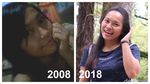 10 Years Challenge Versi Para Survivor Kanker yang Penuh Perjuangan