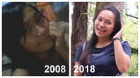 Aku nggak botak waktu kemo, cuma rontok aja makanya digunting, kenang Stella ketika menunjukkan fotonya di tahun 2009. Stella (23) adalah survivor leukemia yang telah sukses melewati masa-masa sulit bergelut dengan penyakit, dan kini menjadi guru. Foto: dok: pribadi via detikHealth