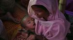 800 Pengungsi Rohingya di Bangladesh Terjangkit Cacar Air