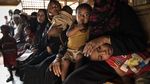 800 Pengungsi Rohingya di Bangladesh Terjangkit Cacar Air