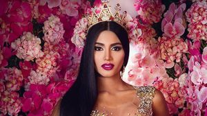 Foto: Pemenang Ketiga Miss Universe 2018 yang Dihujat karena Operasi Plastik
