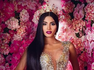 Foto: Pemenang Ketiga Miss Universe 2018 yang Dihujat karena Operasi Plastik