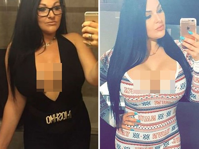 Vicky operasi plastik karena ingin mirip bintang porno. Foto: Twitter Vicky operasi plastik karena ingin mirip bintang porno. Foto: Twitter