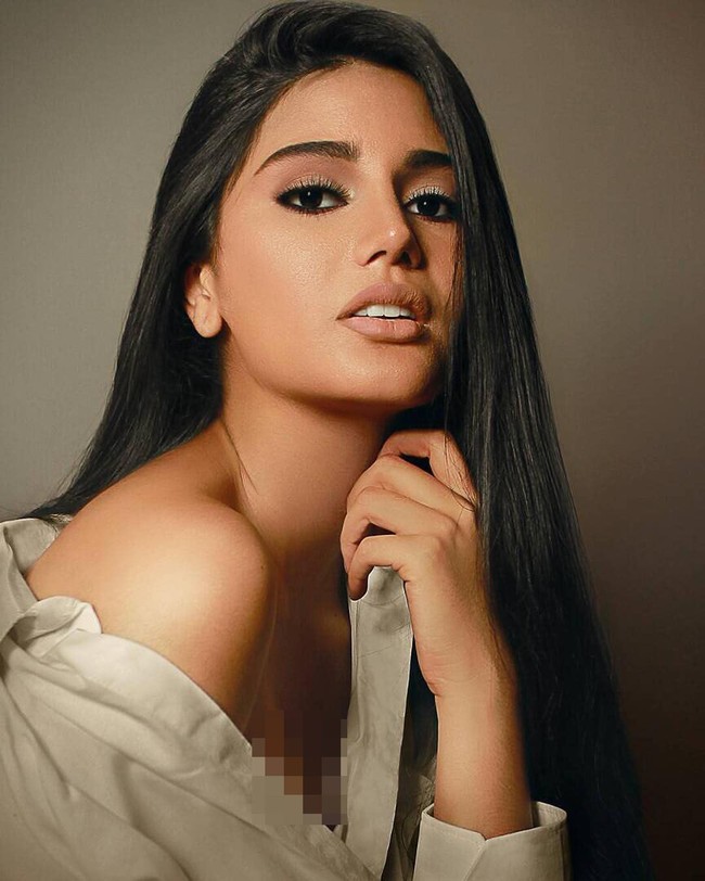 Peningkatan bedah plastik bukanlah hal baru di Venezuela. Menurut laporan 2018 oleh CGTN, banyak model masih menjalani prosedur bedah kosmetik meskipun di negara itu sedang krisis ekonomi. Foto: Instagram @sthefanygutierrez1