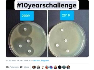 10 Years Challenge yang Ini Bikin Takut Minum Antibiotik