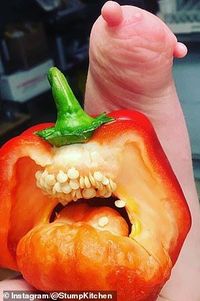 Tak Punya Tangan Kiri, Wanita Ini Gunakan Benjolan di Tangannya untuk Masak