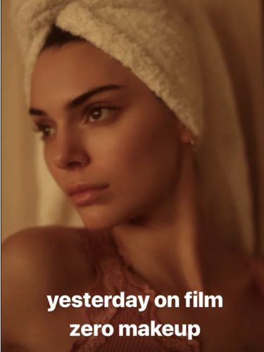 Curhat Kendall Jenner Pernah Jerawatan Parah, Sampai Bikin Dirinya Minder