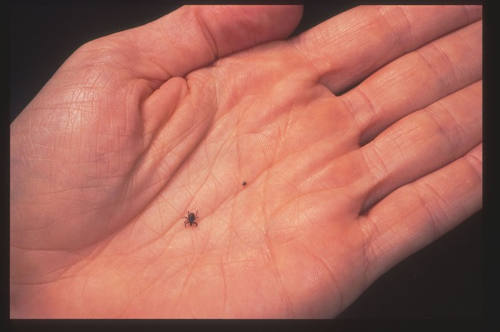 390650 03: A Close Up Of An Adult Female And Nymph Tick Is Shown June 15, 2001 On A Fingertip. Ticks Cause An Acute Inflammatory Disease Characterized By Skin Changes, Joint Inflammation, And Flu-Like Symptoms Called Lyme Disease.  (Photo By Getty Images)