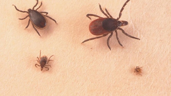 Parasit kutu 390650 03: A Close Up Of An Adult Female And Nymph Tick Is Shown June 15, 2001 On A Fingertip. Ticks Cause An Acute Inflammatory Disease Characterized By Skin Changes, Joint Inflammation, And Flu-Like Symptoms Called Lyme Disease. (Photo By Getty Images)