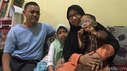 Hampir 5 tahun Kanzu mengidap Bruck syndrome, yang diketahui hanya ada 40 kasusnya di dunia. Namun ia dan keluarga menghadapinya dengan semangat dan gembira.