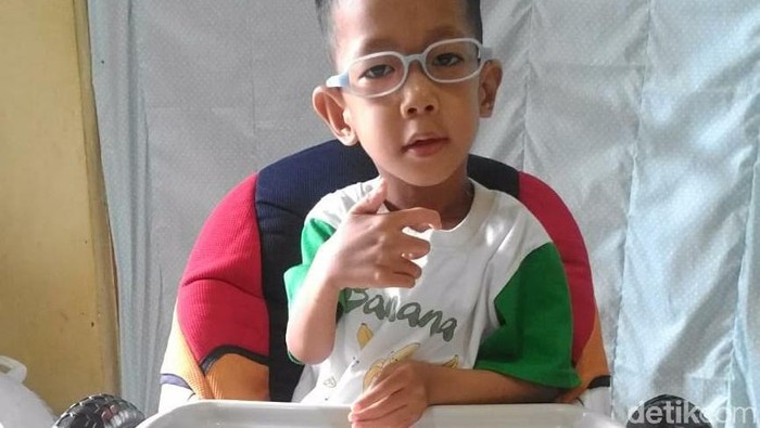 kanzu, pengidap bruck syndrome pertama di Indonesia. Foto: Frieda Isyana Putri/detikHealth kanzu, pengidap bruck syndrome pertama di Indonesia. Foto: Frieda Isyana Putri/detikHealth