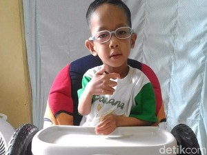 Kanzu dan Perjuangannya Lawan Penyakit Super Langka di Dunia
