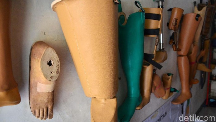 Kaki Palsu Buatan Penyandang Disabilitas Ini Tembus Malaysia Meski tidak memiliki kaki, Indra Semedi (45) tidak kehilangan kreativitas dan naluri bisnisnya. Indra membuat kaki dan tangan palsu yang menembus pasar Malaysia.