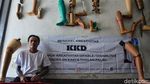 Kaki Palsu Buatan Penyandang Disabilitas Ini Tembus Malaysia