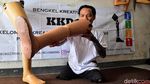 Kaki Palsu Buatan Penyandang Disabilitas Ini Tembus Malaysia