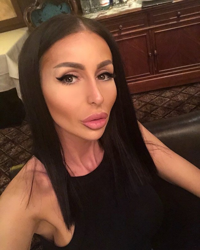 Bagaimana kamu bisa menyukai bibirmu yang seperti ini, tulis netizen. Penampilanmu seperti monster, ujar netizen lainnya. Foto: Intagram (@desi_dimitrov)