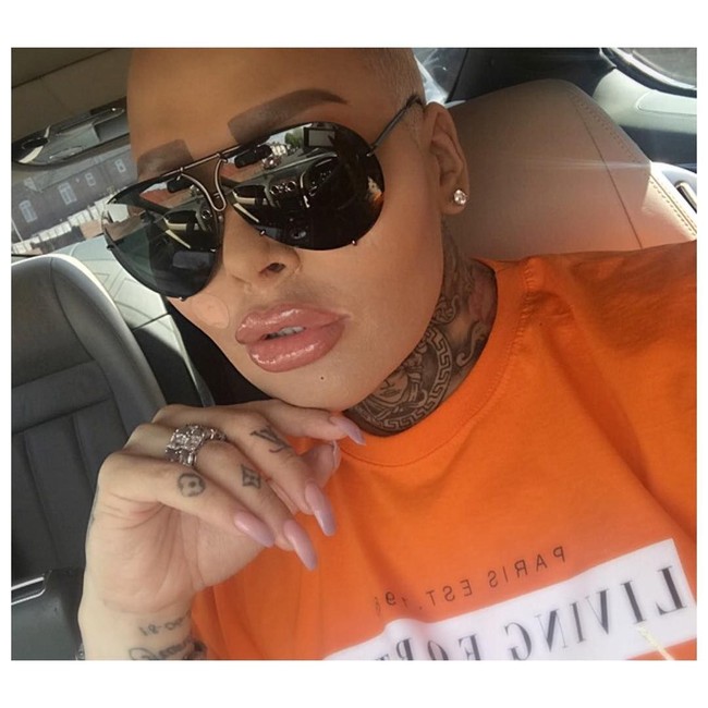 Dalam acara reality show tentang operasi plastik berjudul Botched, James meminta dokter untuk memperbaiki masalah pernapasannya. Namun ia tetap ingin kembali melakukan operasi hidung agar lebih kecil lagi.  Foto: dok. Instagram