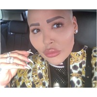 Pria yang melabeli dirinya sebagai raja bibir itu mengaku kesulitan bernapas karena hidungnya yang kini sudah semakin mancung dan mengecil.  Foto: dok. Instagram