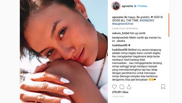Posting Ini, Ada yang Berubah dari Hidung Agnez Mo?