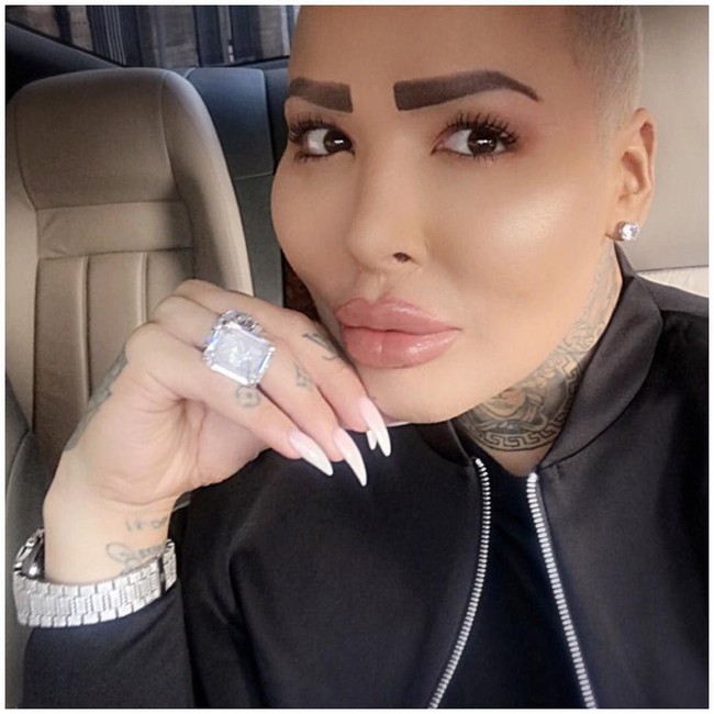 Kini Jordan mengalami masalah kesehatan karena kebanyakan operasi plastik. Dia telah melakukan empat kali operasi hidung. Foto: dok. Instagram