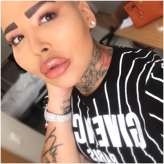 Ini Jordan James Parke, pria yang terobsesi operasi plastik demi mirip Kim Kardashian. Bikin kagetnya lagi, James sudah melakukan operasi plastik sebanyak 50 kali.  Foto: dok. Instagram