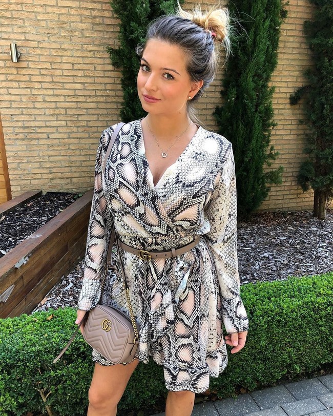 Ia mengatakan bahwa ia seperti dipenjara. Belum lagi dengan banyaknya aturan dan tekanan yang harus ditaati seperti harus selalu menggunakan bikini dan high heels.  Foto: dok. Instagram