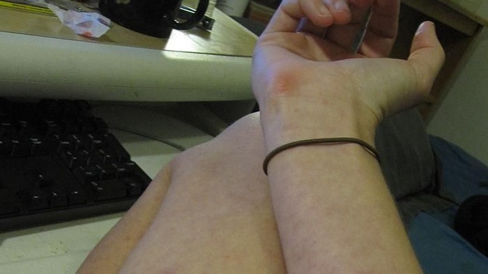 Flu Tulang Adalah: Gejala, Penyebab, dan Cara Mencegah