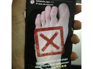 Sepatu Puluhan Juta Bikin Kaki Bella Shofie Lecet, Apa Penyebabnya?