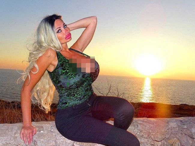 Wanita yang bekerja sebagai model dan bintang reality show itu telah melakukan sederet prosedur kecantikan di antaranya pembesaran payudara, operasi hidung, implan bibir, sedot lemak, injeksi lemak hingga suntik Botox. Foto: Twitter @VictoriaWildxxx