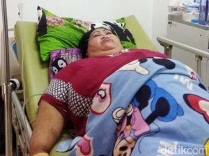 Penjelasan Dokter soal Penyebab Sunarti Berbobot 148 Kg