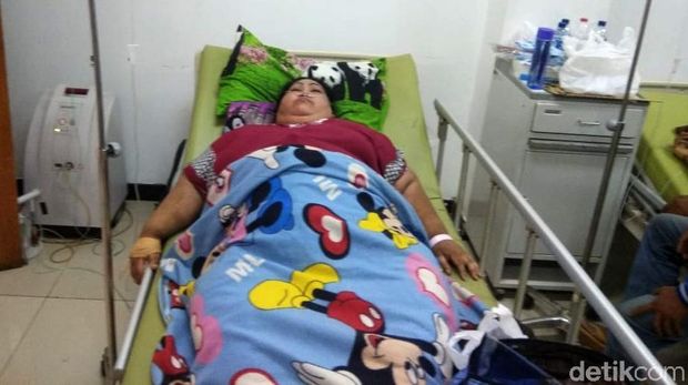 Cerita Perjuangan Sunarti Lawan Obesitas hingga Tutup Usia